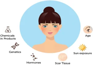 causes of pigmentation