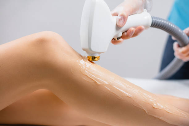 Laser Hair Removal