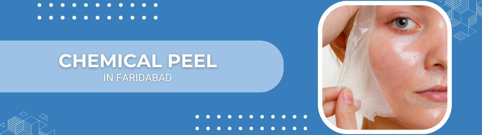 Chemical_peel Chemical_peel