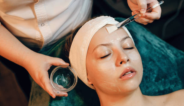 Chemical peels