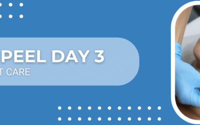Chemical peel day 3 – Post care