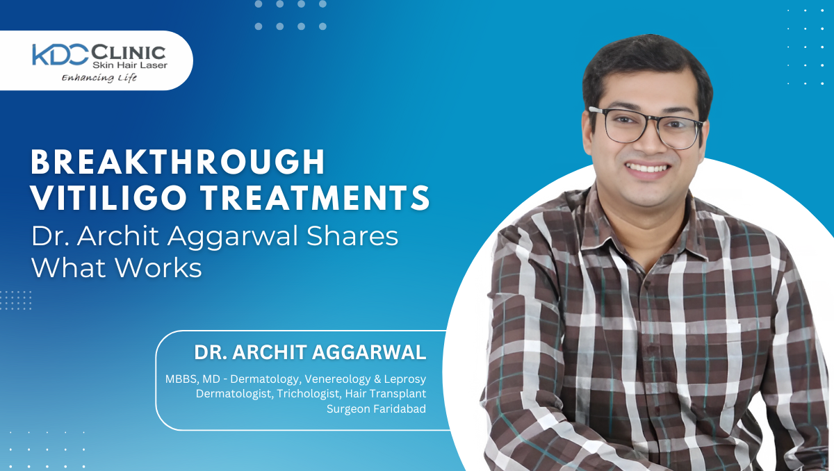 Dr. Archit Aggarwal on Modern Vitiligo Treatments: What Really Works