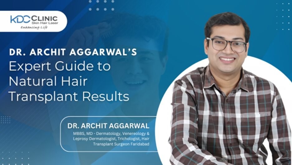 Hair Transplant Solutions: Dr. Archit Aggarwal Discusses Natural-Looking Results for Hair Loss