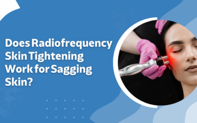 Does Radiofrequency Skin Tightening Work for Sagging Skin?