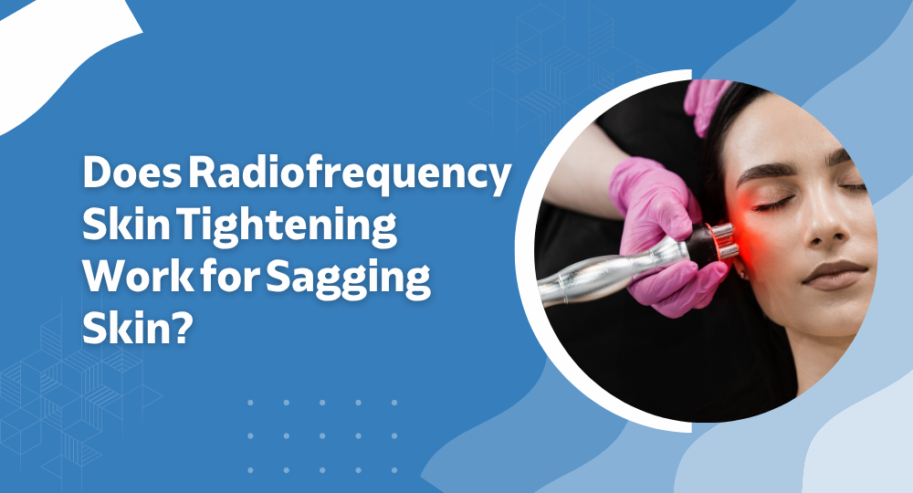 Does Radiofrequency Skin Tightening Work for Sagging Skin