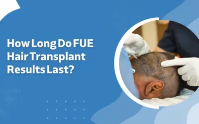 How Long Do FUE Hair Transplant Results Last?