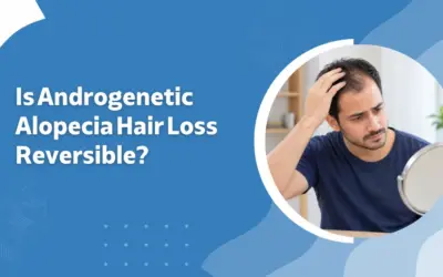 Is Androgenetic Alopecia Hair Loss Reversible?