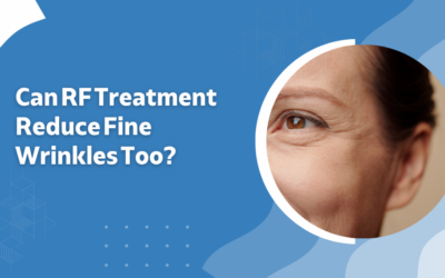 Can RF Treatment Reduce Fine Wrinkles Too?